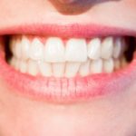 Przepiękne nienaganne zęby także doskonały uroczy uśmieszek to powód do zadowolenia.